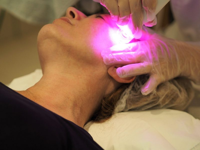 bodyvie microdermabrasion treatment